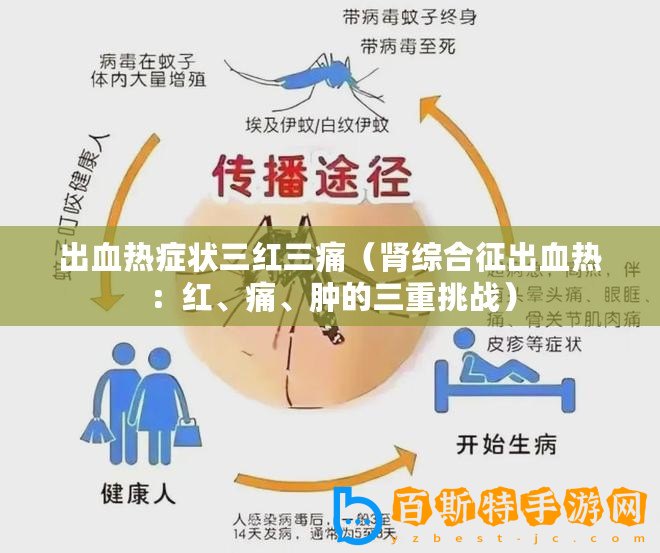出血熱癥狀三紅三痛（腎綜合征出血熱：紅、痛、腫的三重挑戰）