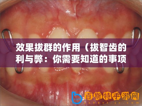 效果拔群的作用（拔智齒的利與弊：你需要知道的事項(xiàng)）
